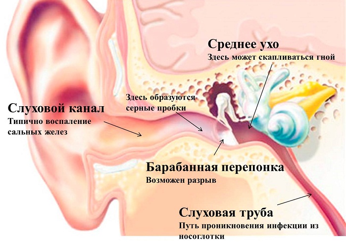 Болит внутри уха